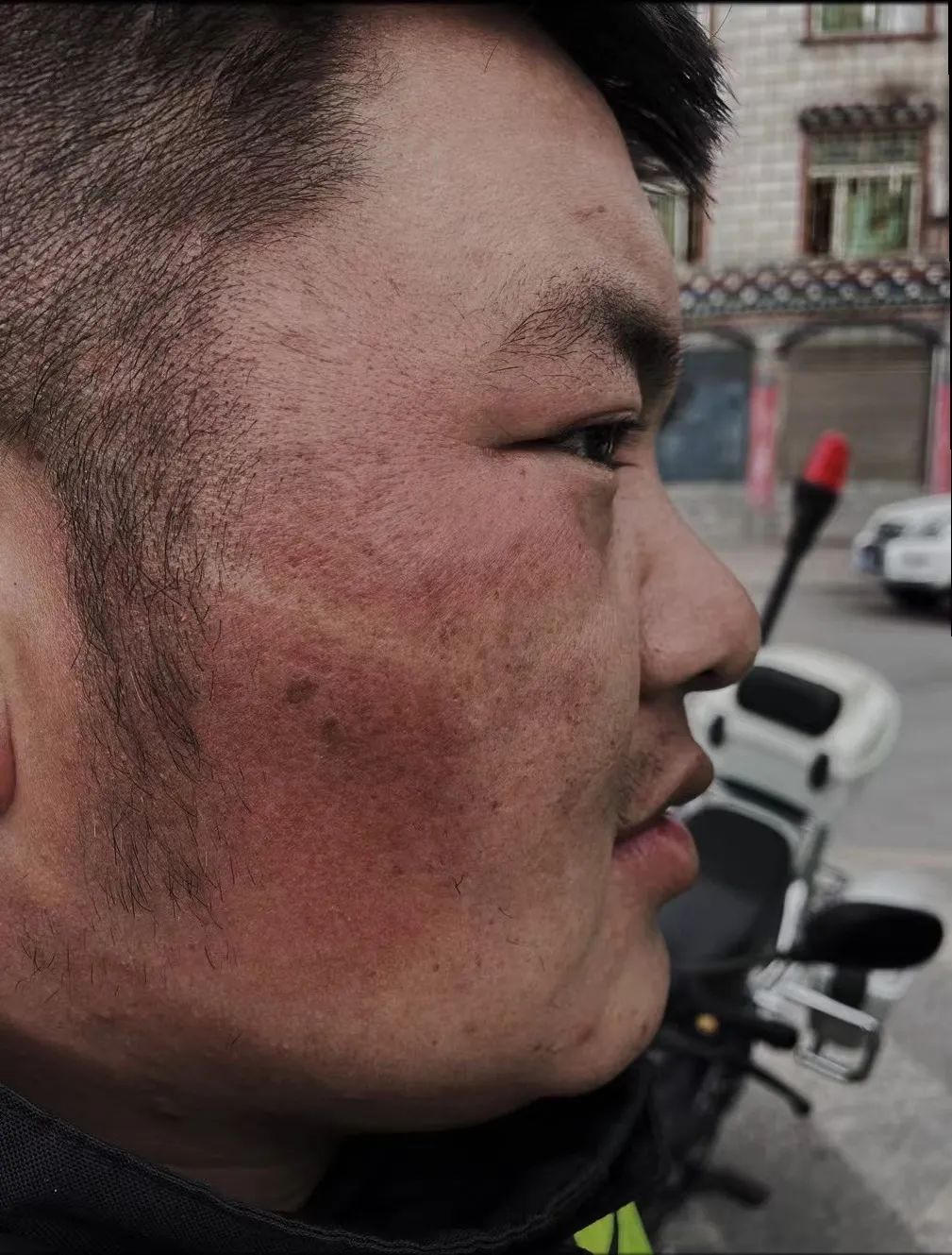 你脸上有没有"口罩印"?