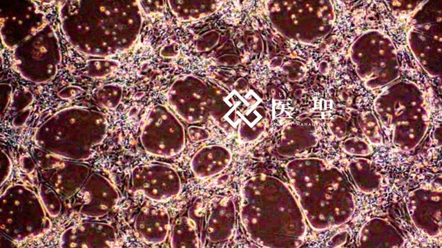日本用ips细胞治疗心力衰竭开始临床试验
