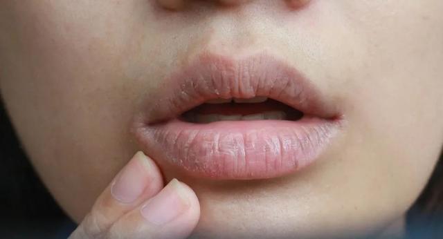 唇干手糙脚起皮!远离冬季干燥,一篇拯救你