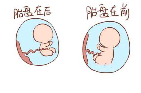 胎盘前壁比后壁更显怀?孕妈妈了解下怀孕的知识,注意胎盘状况