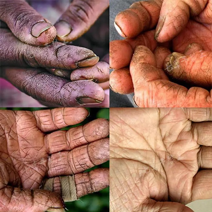 云翠仙手上皴一寸厚的无赖娶了貌若天仙的妻子转手卖给太监