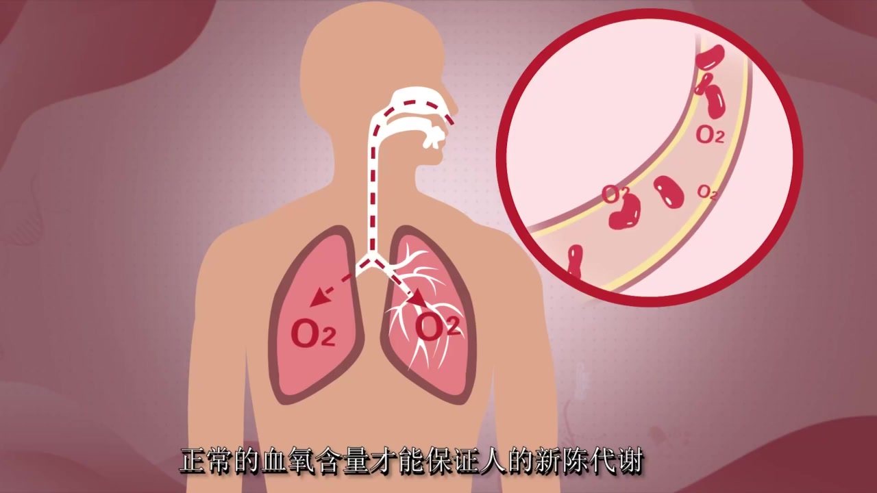 低氧血症为什么要选择氧驱动雾化制氧机