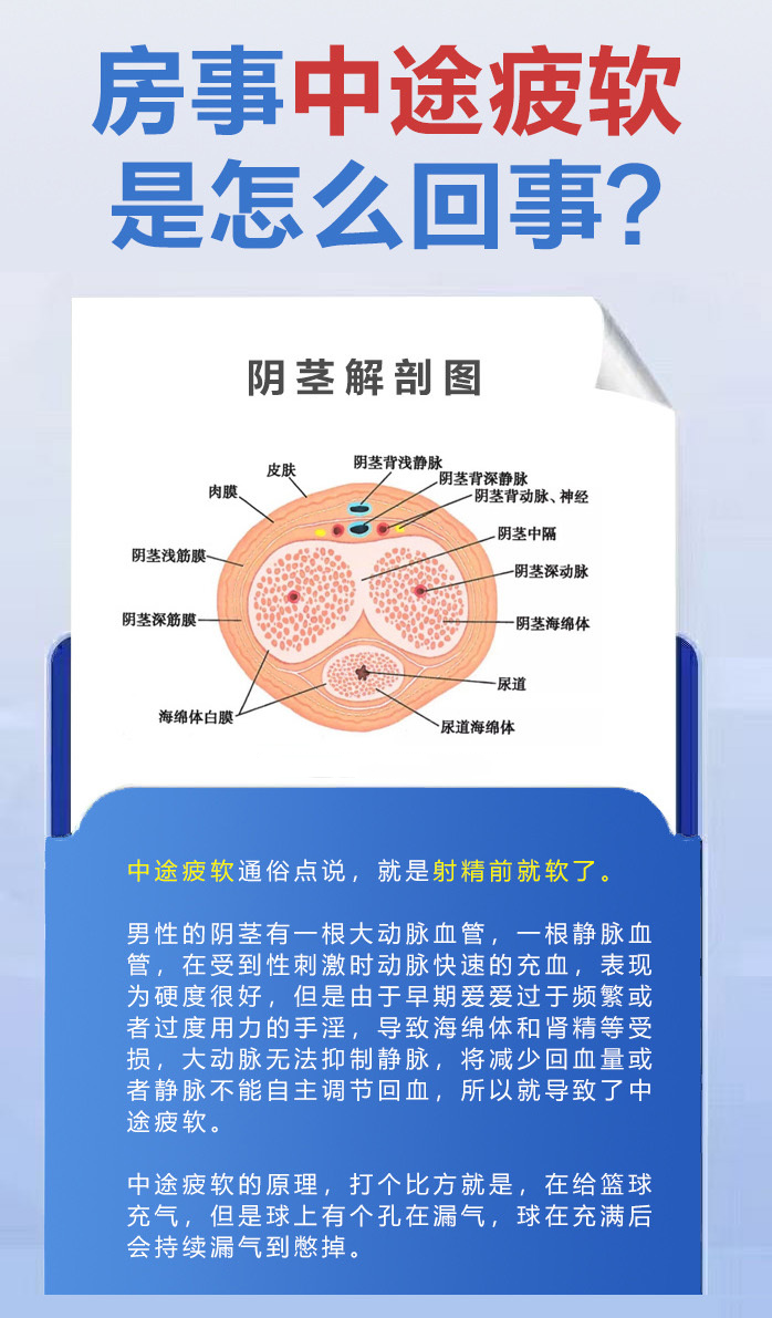 夫妻生活中途疲软,是怎么回事?