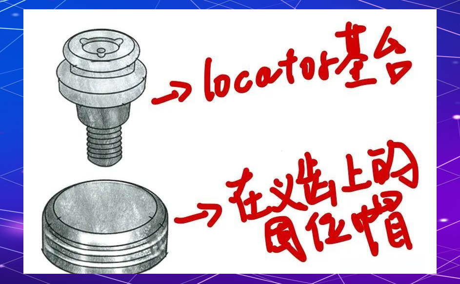 种植覆盖义齿中的locator基台与杆卡附着体解析