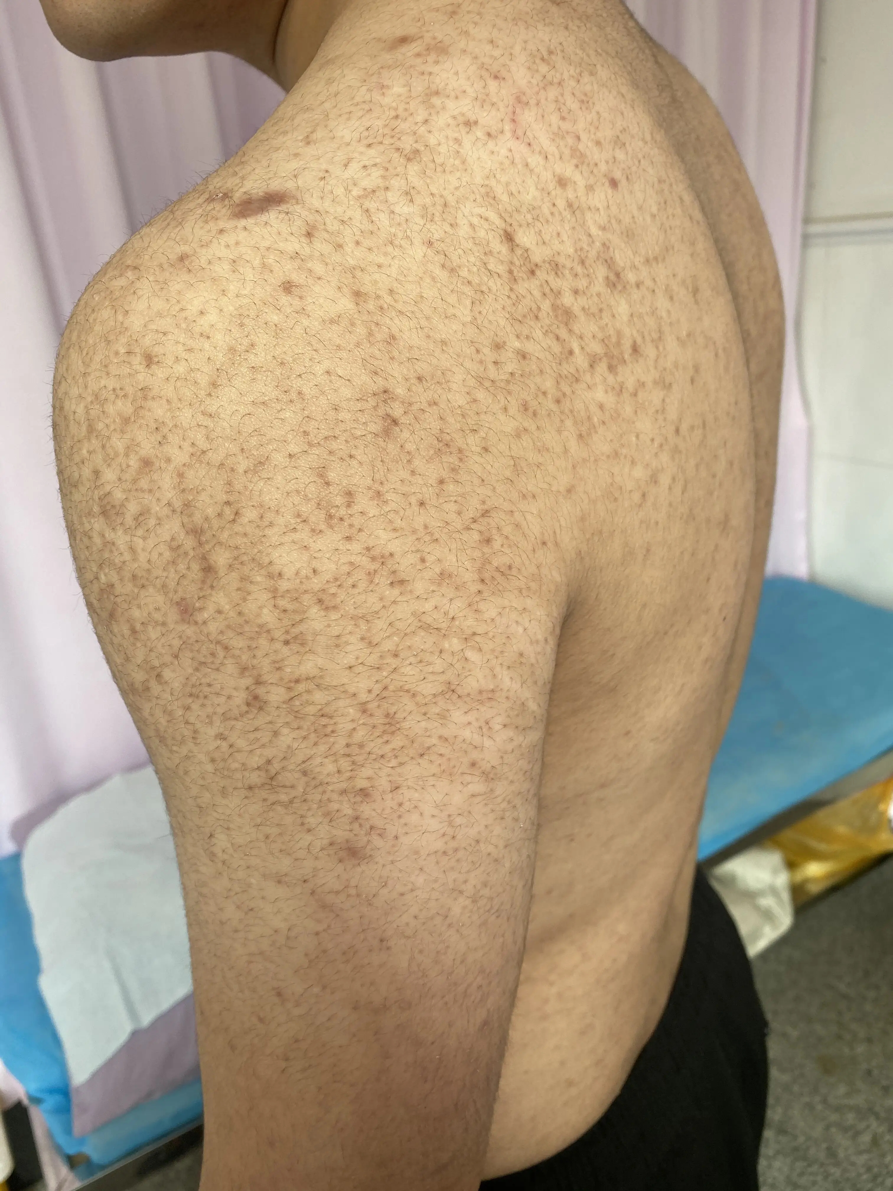 手臂有一些小点点,摸上去毛毛糙糙的