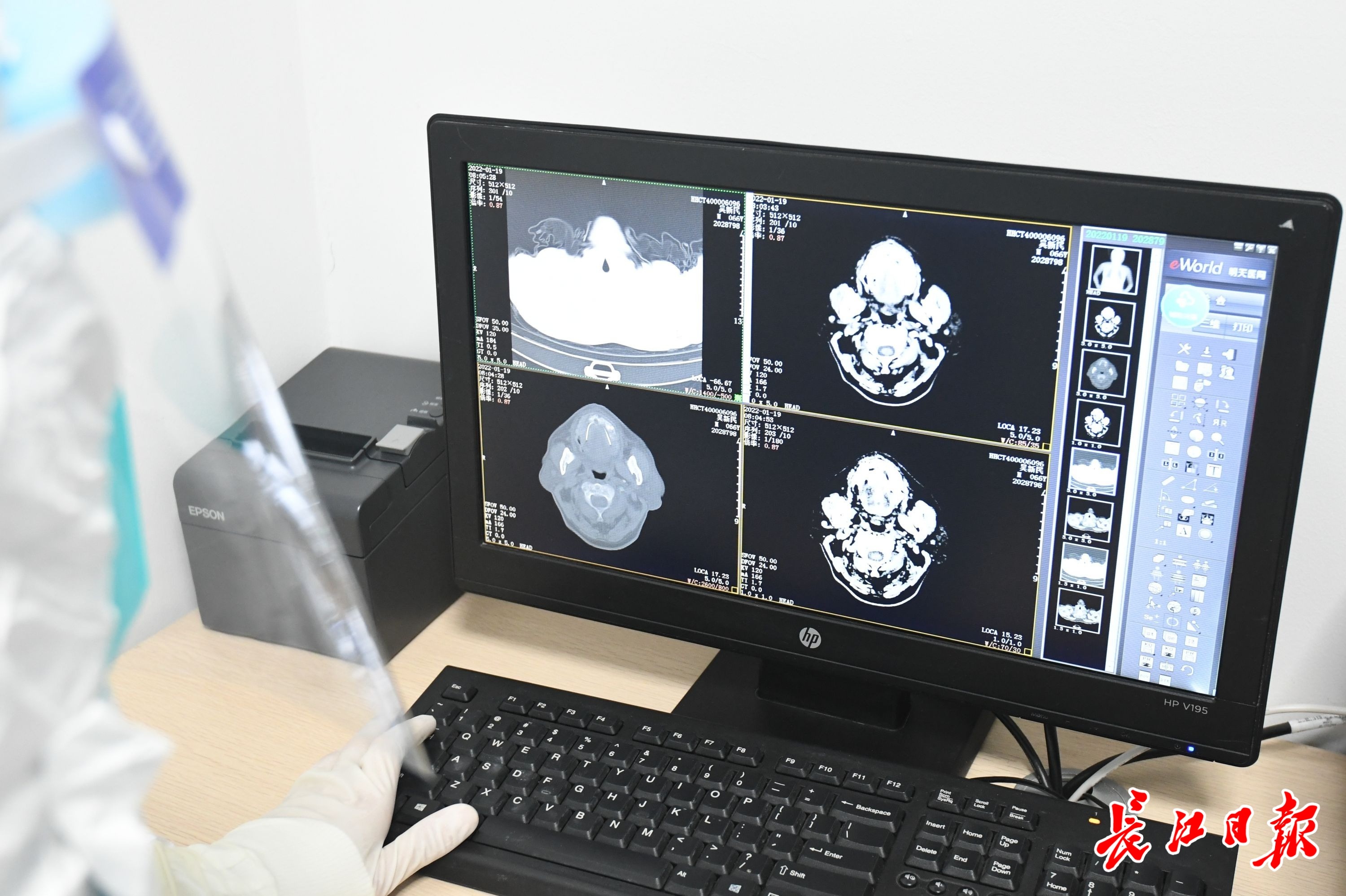 代表委员讨论推行"云胶片",建数字影像平台让看病更便捷