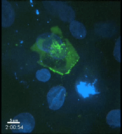 当艾滋病毒"攻陷"人体后,你还有72小时自救