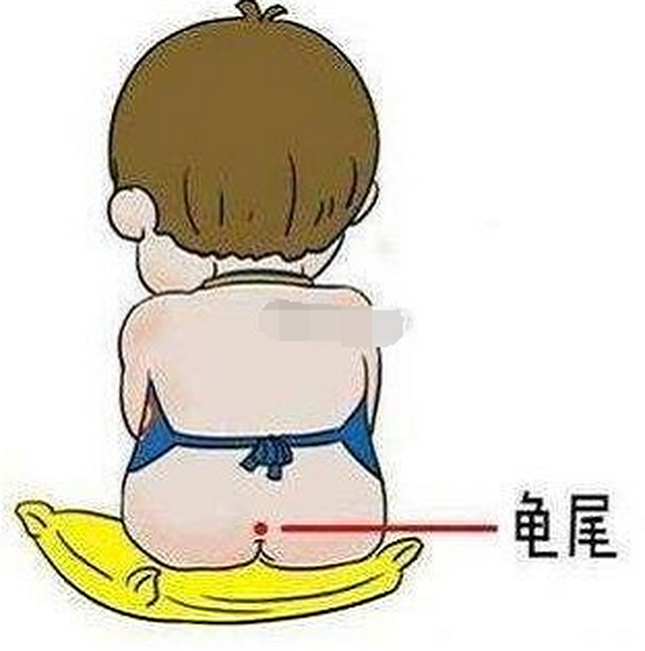 很多人不知道的富贵痣(5)龟尾痣 龟尾痣长在一个人尾椎的位置,它也叫