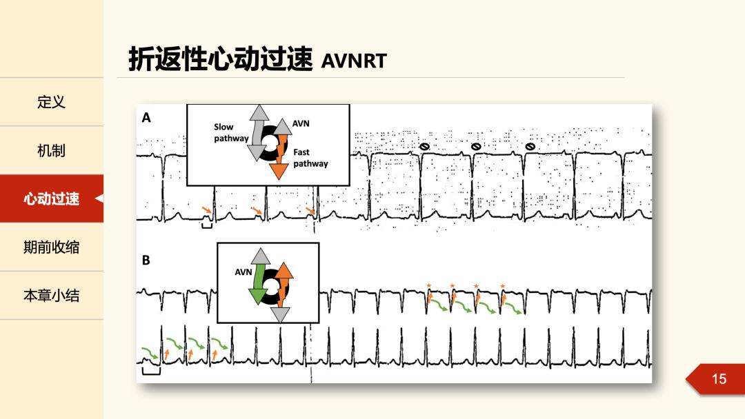 老生常谈