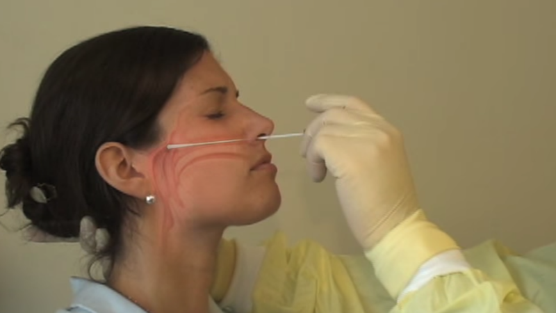 核酸鼻咽拭子检测方法(核酸检测咽拭子鼻拭子哪个准确)