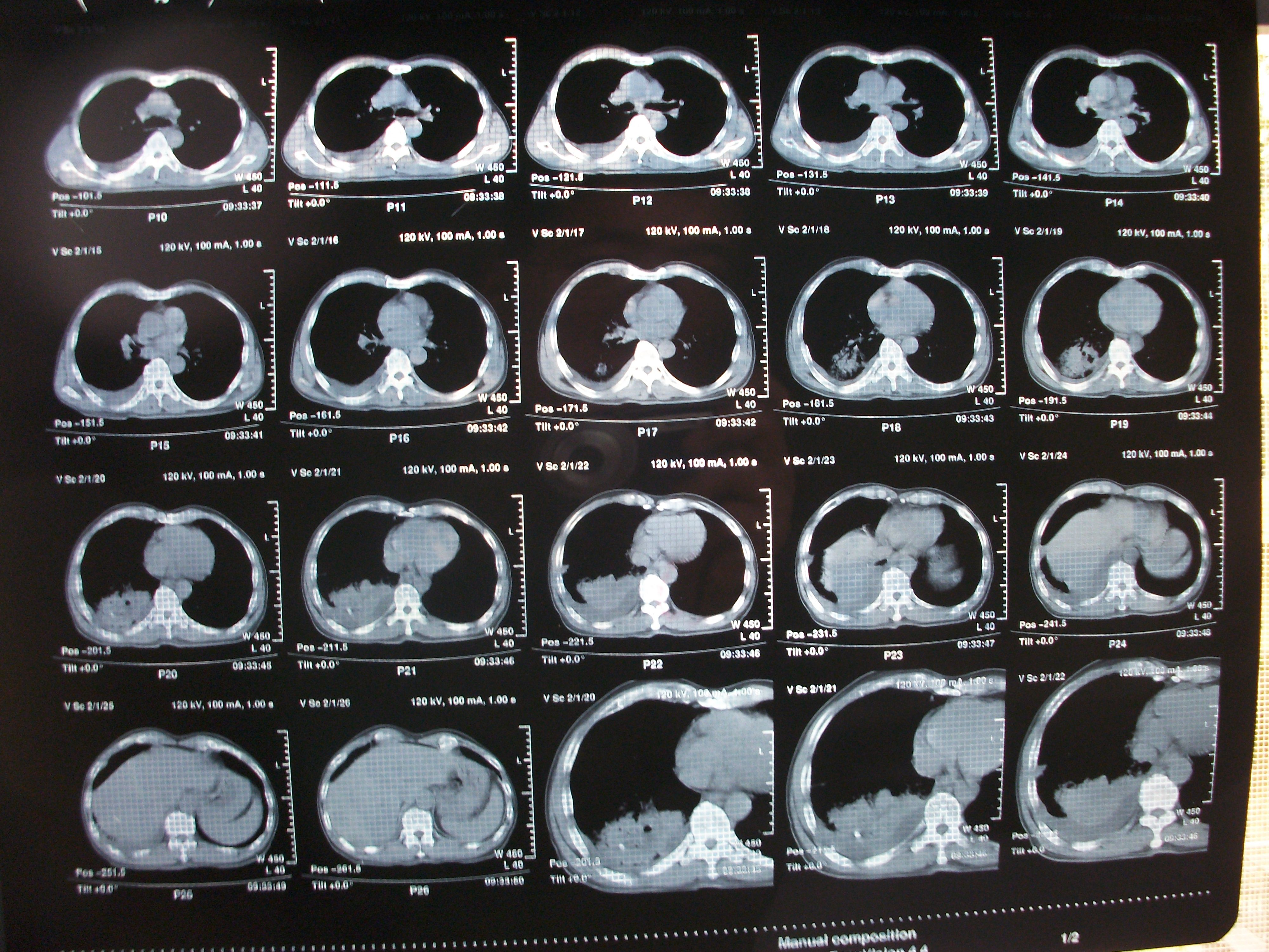 x光,ct,核磁共振有什么区别?三大诊断神器全解析!
