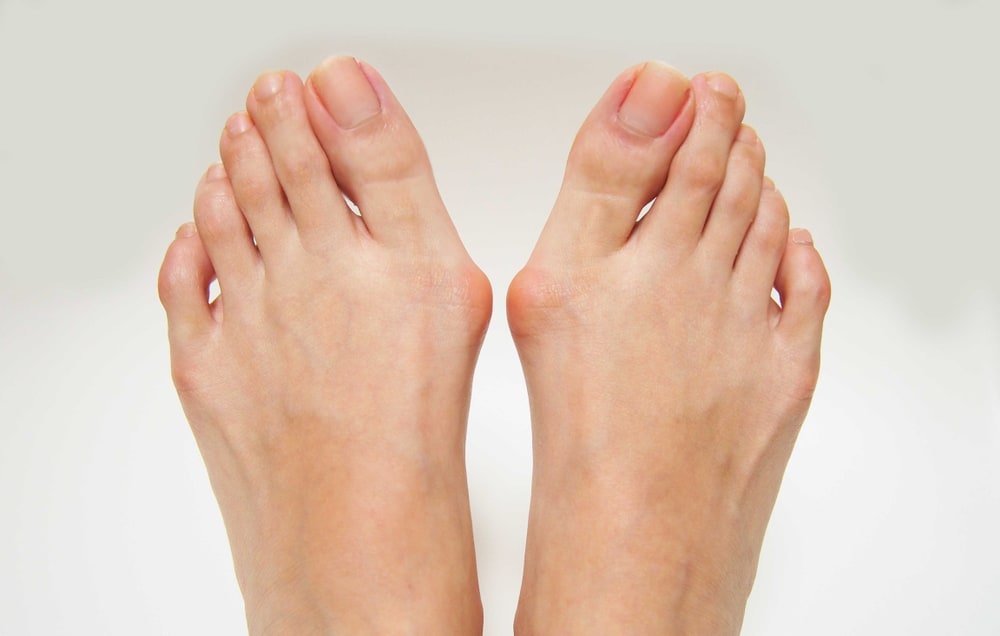 "爆炸性"增生骨骼的"怪病",他们不惜死后展出自己的骨架!