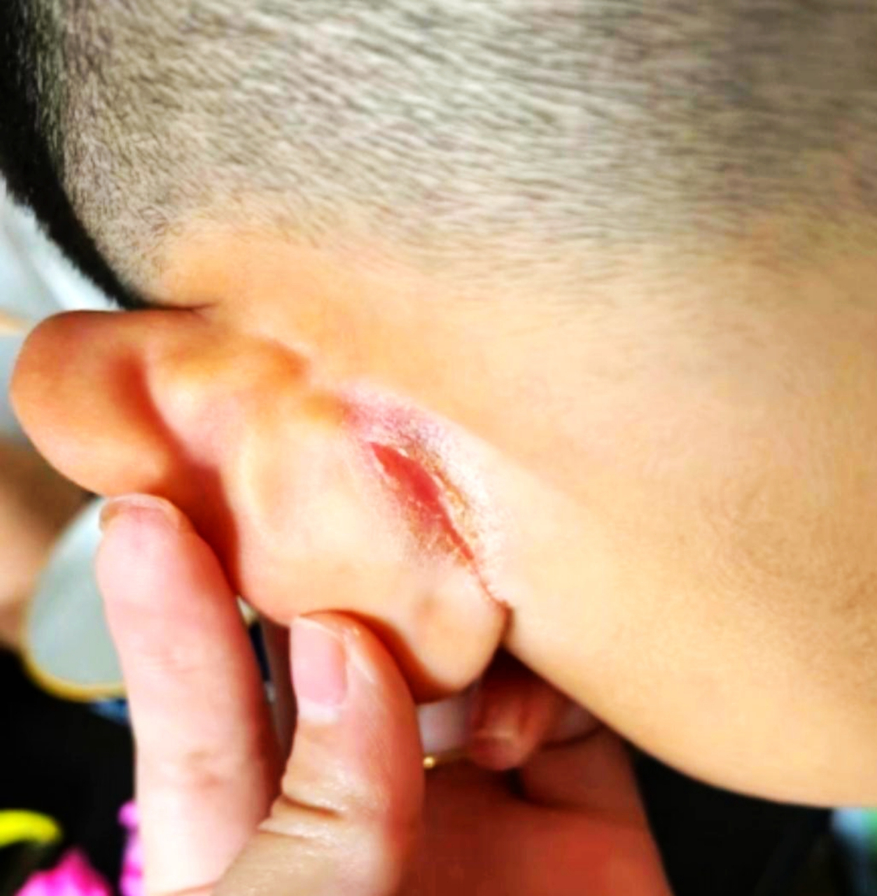 孩子在学校不听话,耳朵扭成这样