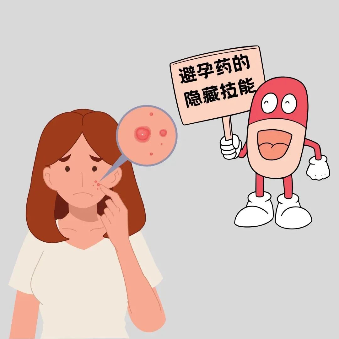 长痤疮,医生为什么让我吃避孕药?