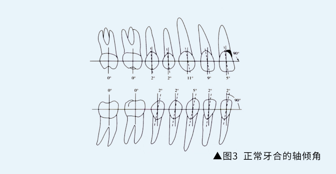 正畸科普 andrews的正常(牙合)六项标准