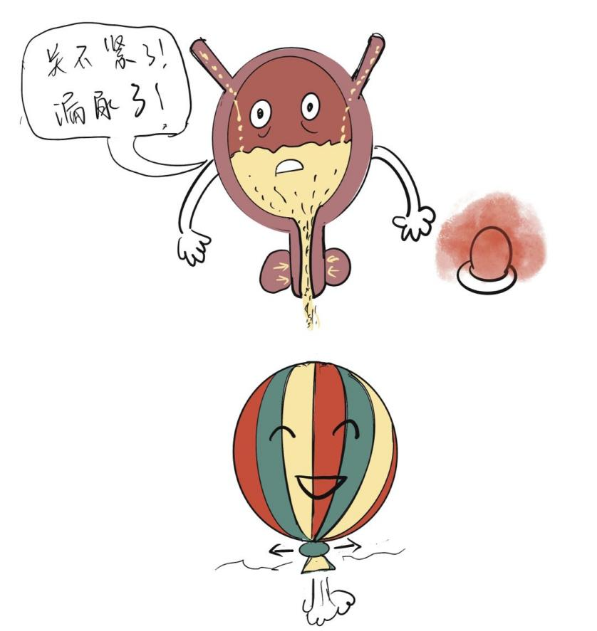 什么是压力性尿失禁怎么预防和治疗医生科普来啦浦东医生话养生