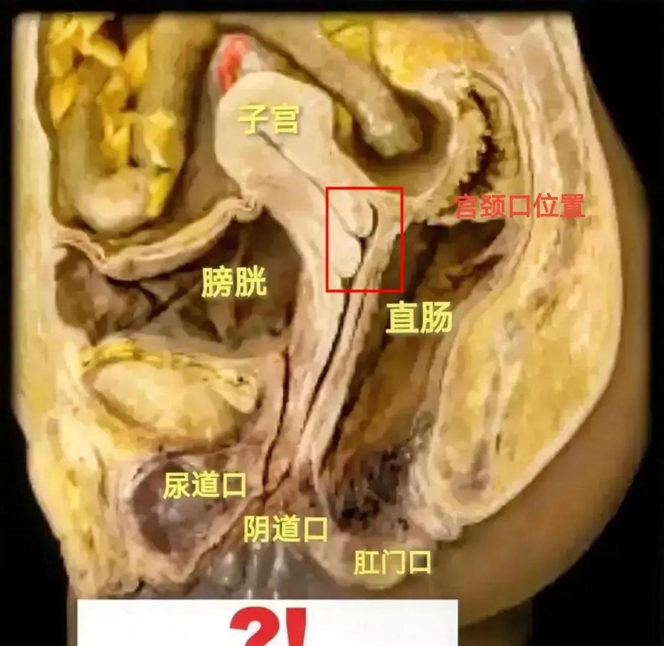 健康的宫颈照片子宫口图片