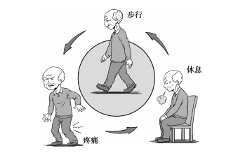 中老年人要当心间歇性跛行!