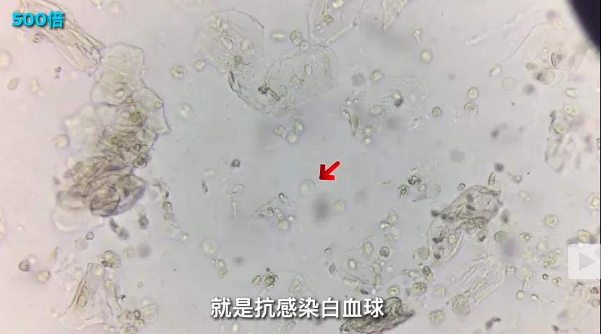 口水放大2000倍後,看完一陣惡寒,為何情侶間接吻不會覺得噁心?