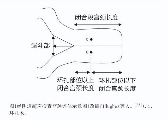 宫颈管长度图片