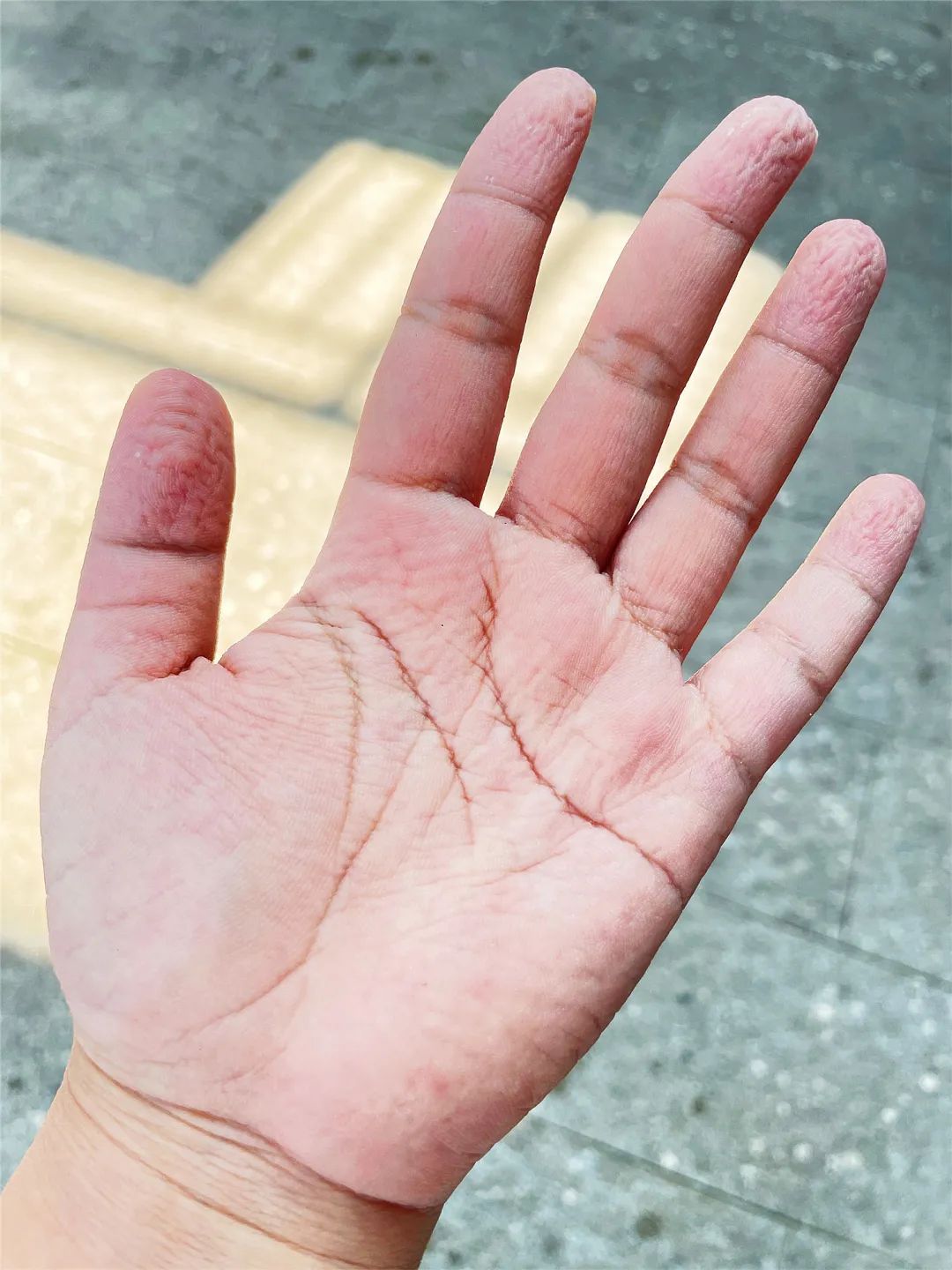 「寻找最美抗疫人」"刻"在手上的"勋章" 那是衡阳人民的深情