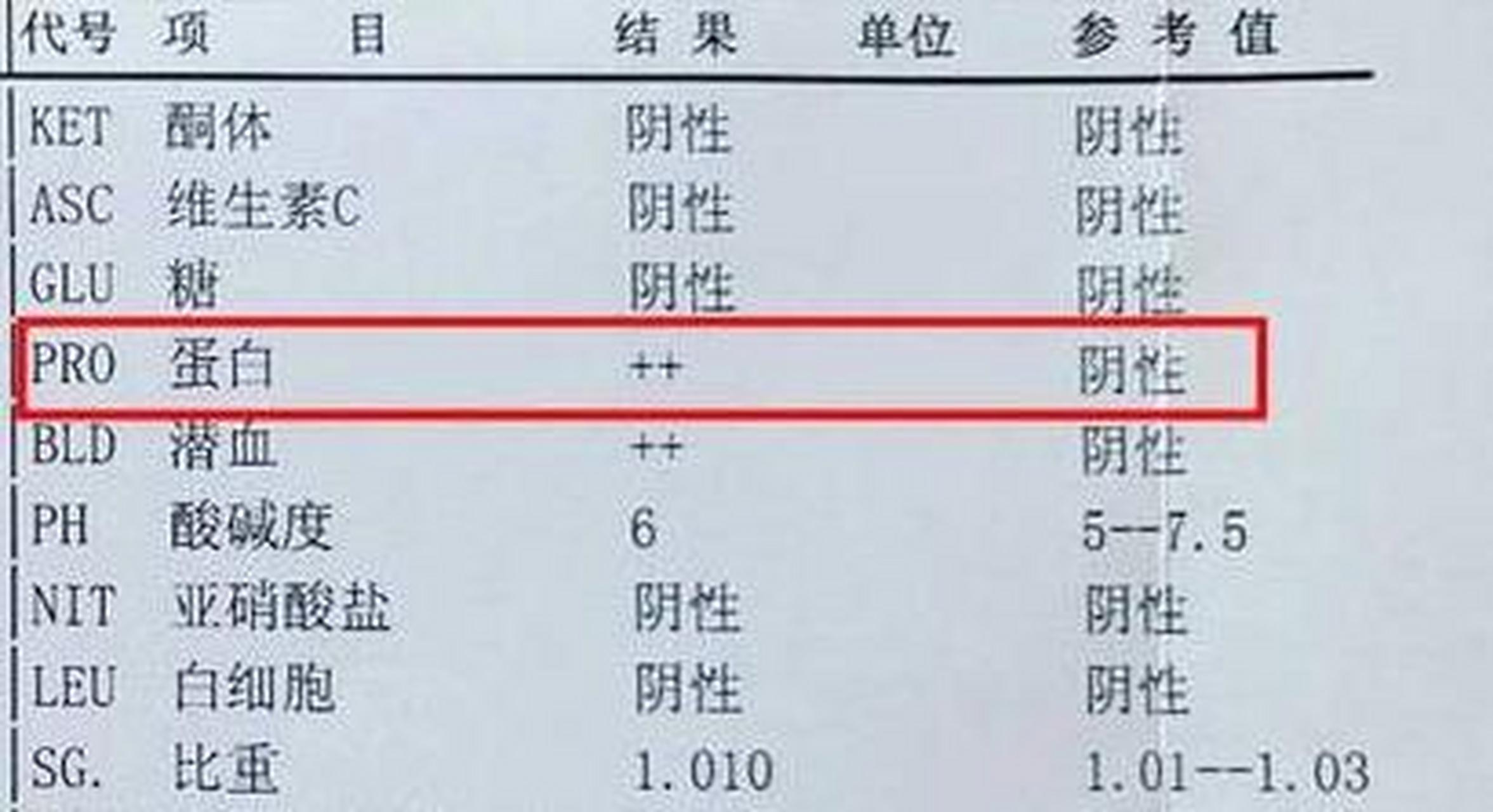 尿蛋白有 号,不一定是肾脏损伤 尿里有 号,很多人就认为是肾脏受损了