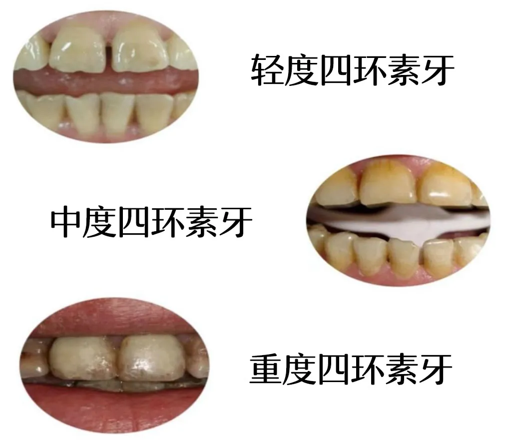 四环素颗粒图片图片