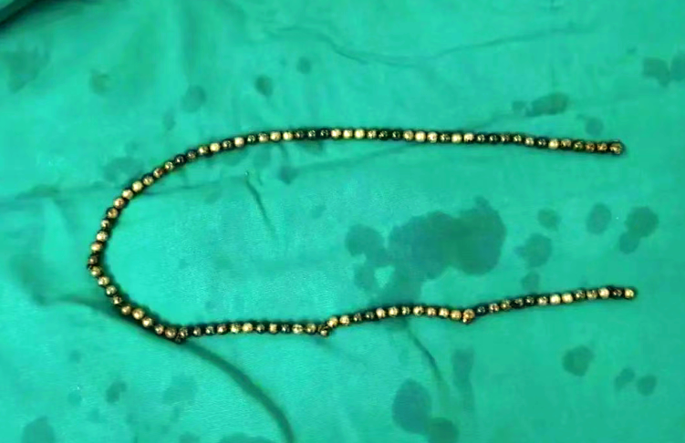 磁力珠小孩吃了会怎么办_小孩吃磁力珠有什么反应 磁力珠小孩吃了会怎么办_小孩吃磁力珠有什么反应（小孩吃磁力珠处理方法） 磁力资讯