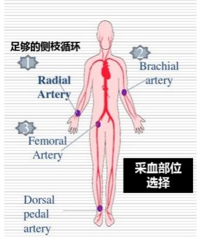 股动脉采血图片