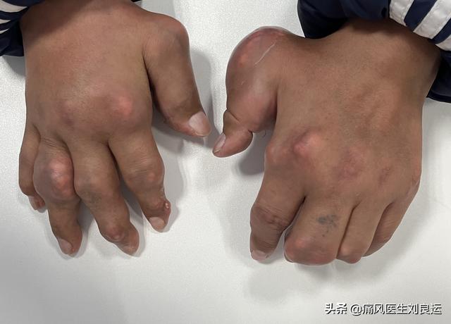 把握治疗目标,选择治疗药物,躲开发作诱因