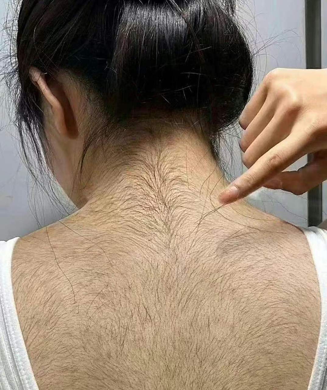 一个女孩子汗毛这么长有什么好办法?