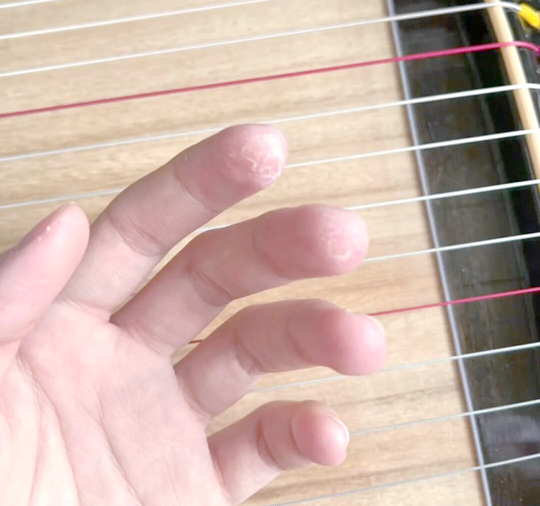 学古筝的手指磨茧之路