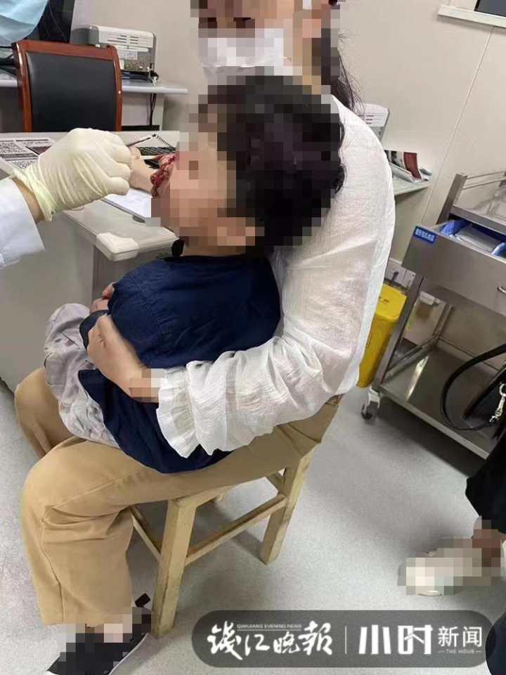 杭州一位小朋友摔了一跤竟咬断舌头,要急送整形医院,爸妈带他上了"警