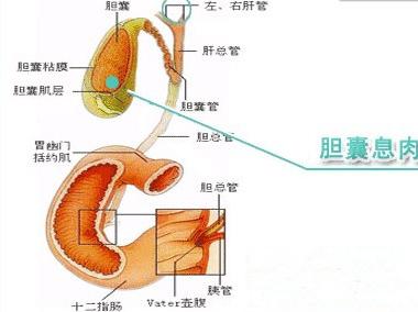 小夥體檢檢查出膽囊息肉來京石求醫,術後點贊醫護暖心服務