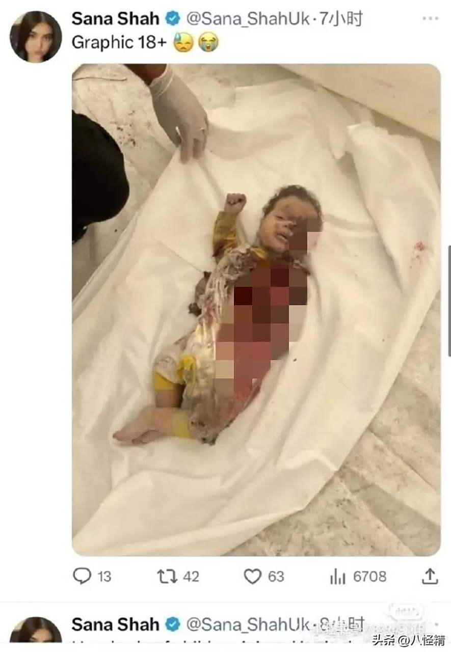 可怜的小宝宝,看着也就五六个月大的样子,身子被炸