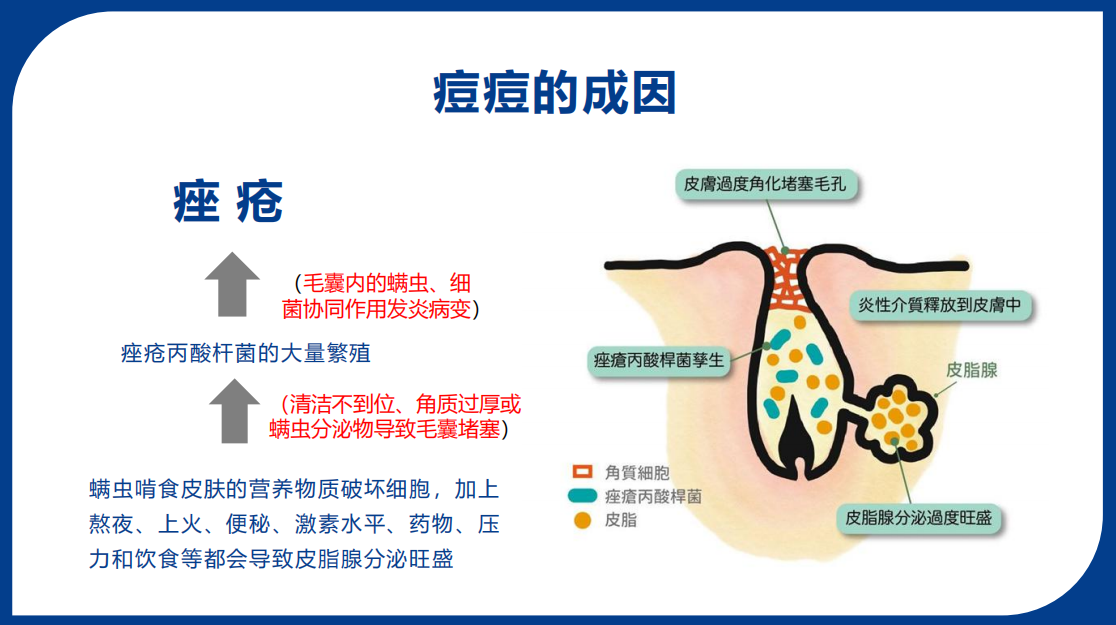 长痘原因图解图片