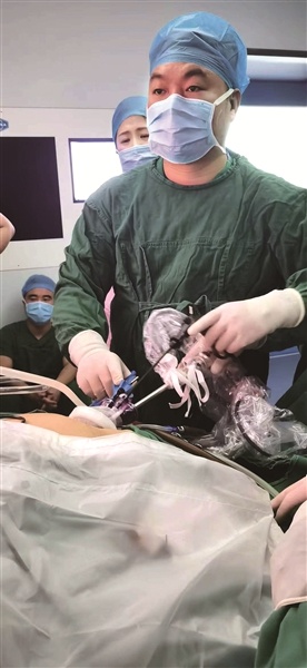 单孔腹腔镜技术让胆结石患者健康与美丽兼得