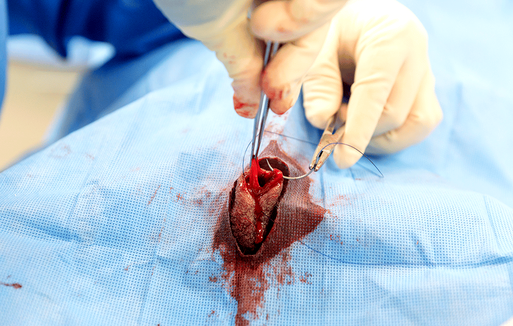 公犬公猫睾丸摘除手术中的多种技术详解:附图解缝合与结扎方法