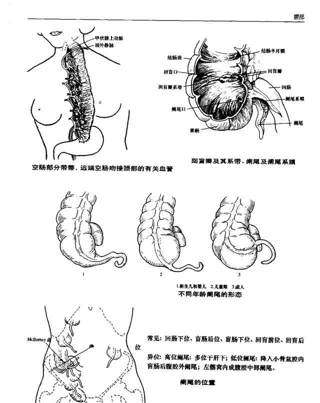 解剖图腹部图片