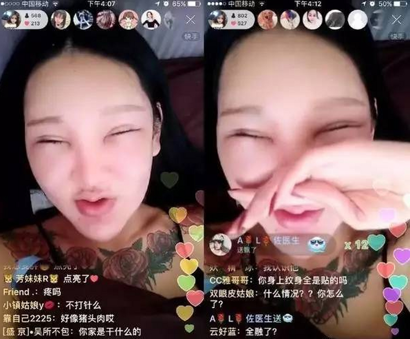 桃花宝宝:八年花费上百万整容,额头出现大坑,如今面临双目失明