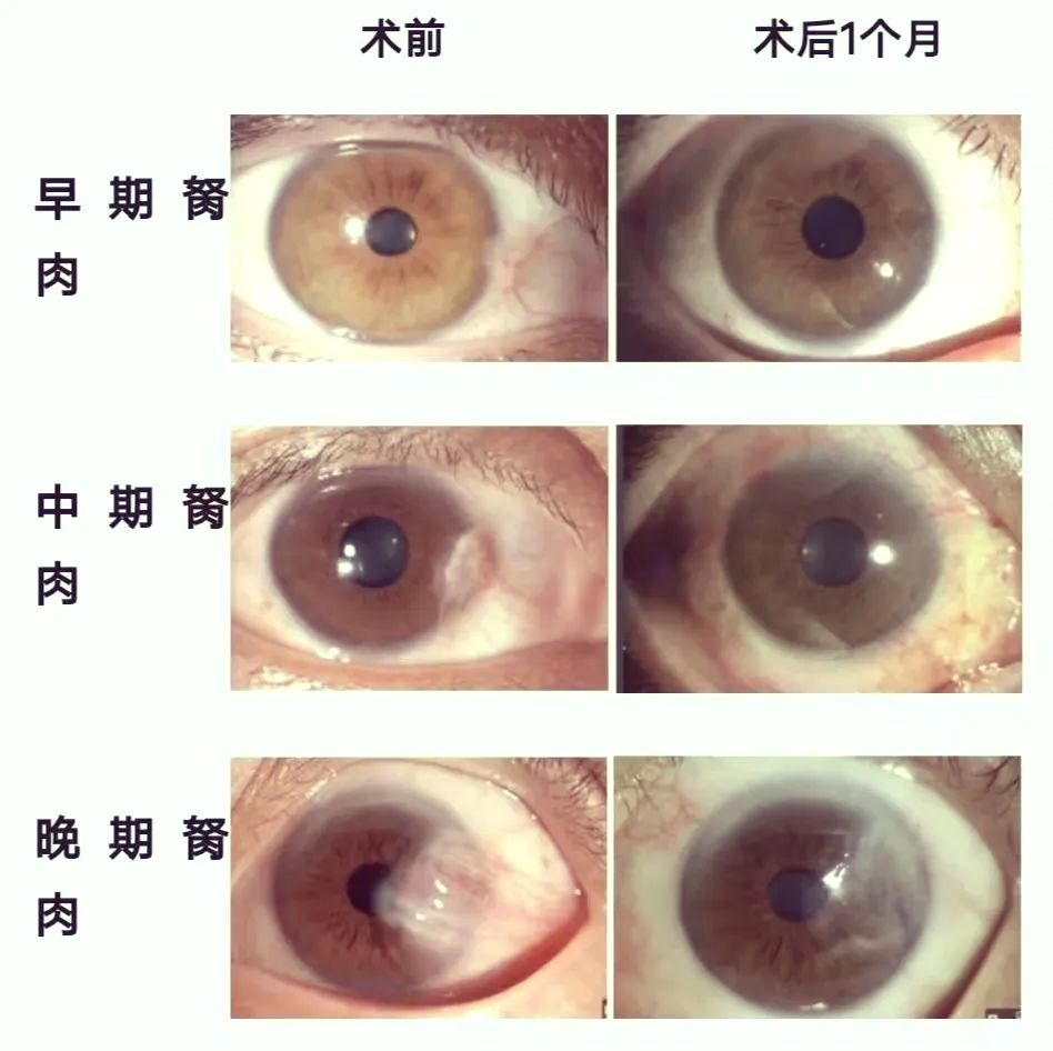 潜伏在眼中的隐患