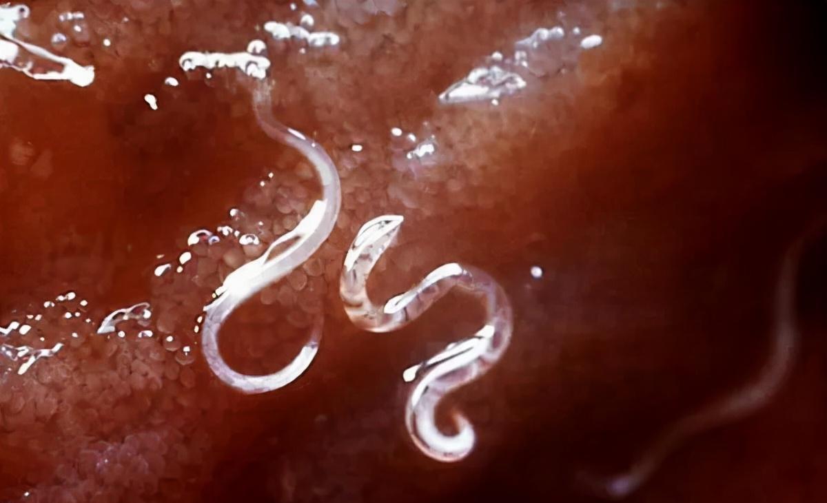 生食肠道寄生虫的危害:潜伏在你体内的恐怖生物!