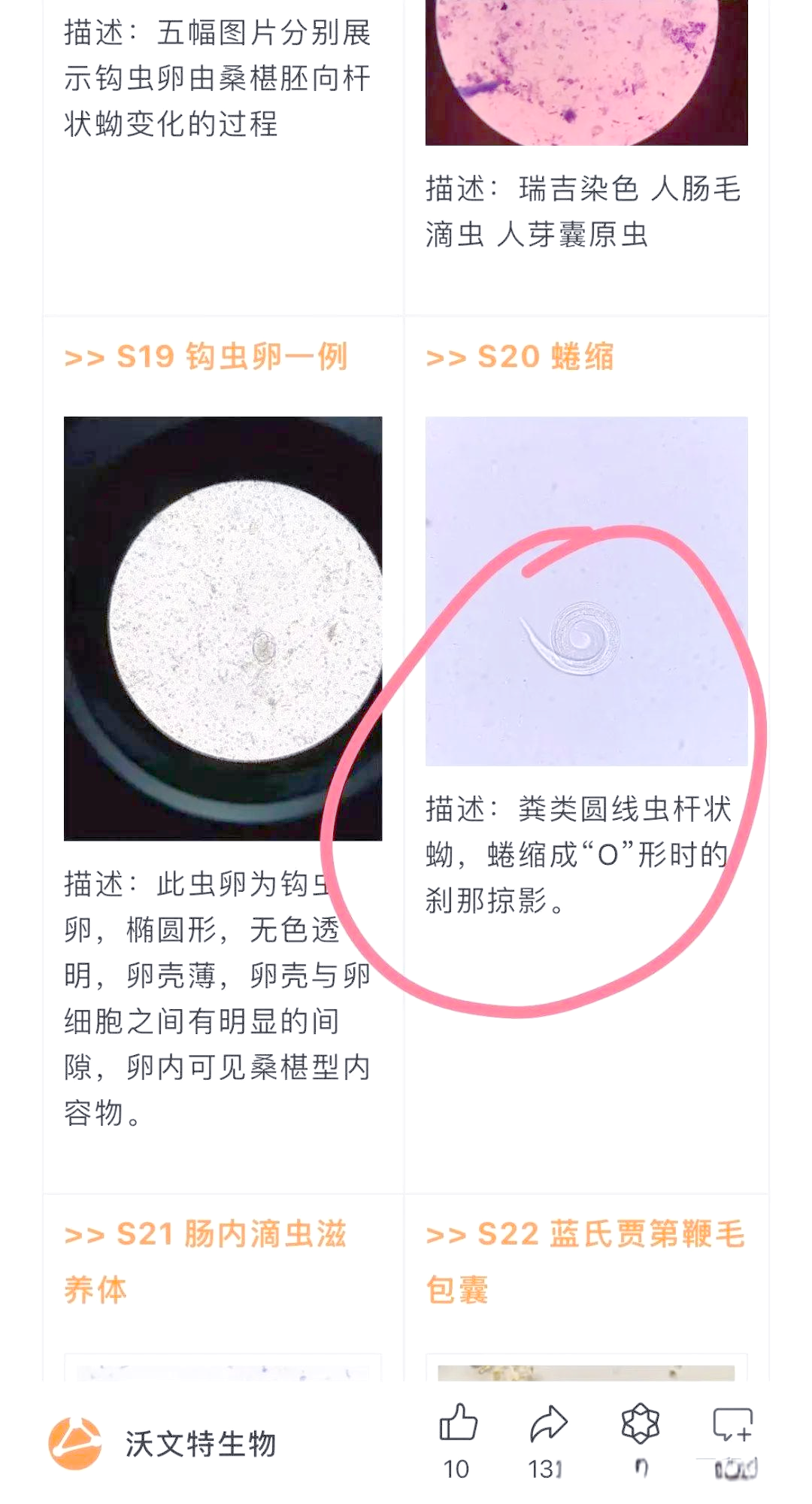 显微镜下的挑战:从质控图看粪类圆线虫