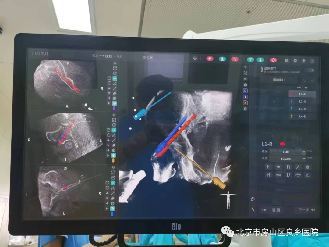 區內首例智能化機器人讓良鄉醫院骨科手術邁入新階段