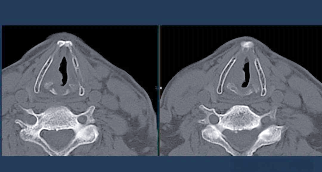 病例介绍及诊断要点详解