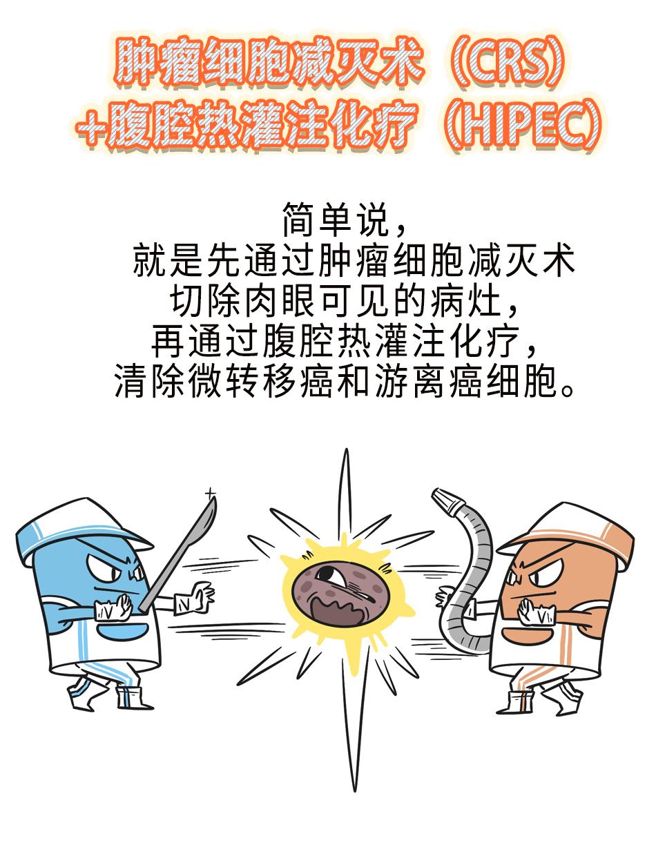 "老大难"腹膜癌能治吗?