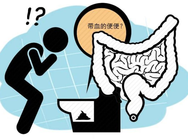 如果没有吃带有色素的食物,大便出现了发黑而且大便带血,这也有可能是