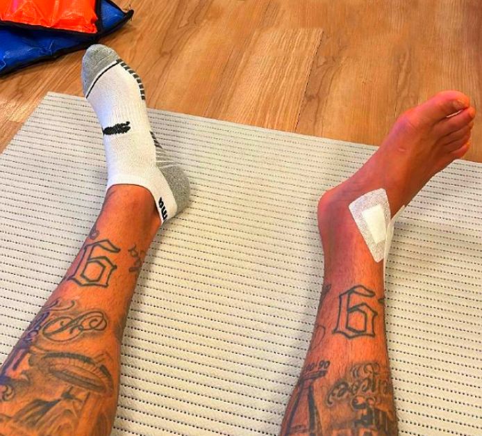 31岁内马尔晒自拍照,看到他脚上纱布那一刻,才知道受伤有多严重