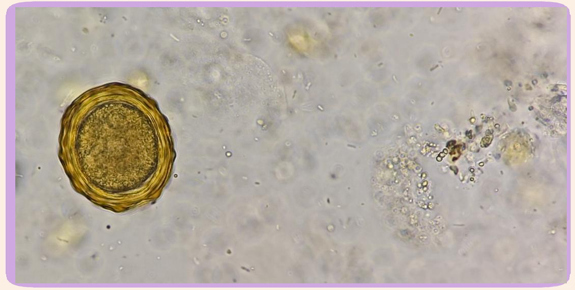 粪便中蛔虫卵的形态学特征及防治方法概述