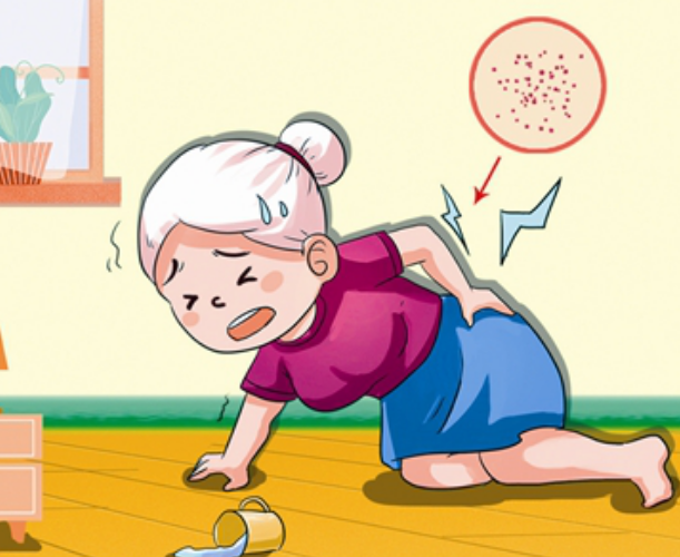 "要命"的髋部脆性骨折!